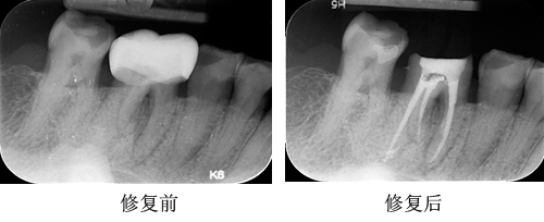 1I00232X-1.jpg
