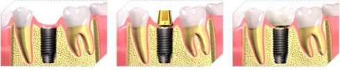 40b24cd4g7932eae3fbe3&690.jpg
