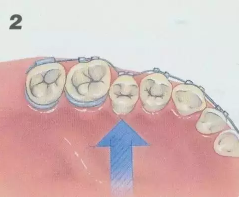 4.png