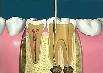 6.png