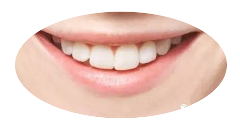 3.png