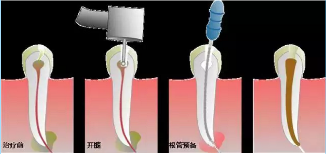 QQ截图20161008143750.png QQ截图20161008143750.png