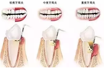 QQ截图20161008150200.png