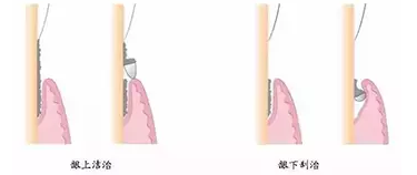QQ截图20161008150220.png