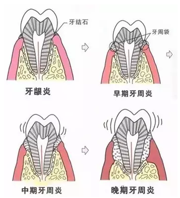 QQ截图20161008150236.png