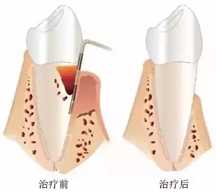 QQ截图20161008150311.png