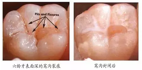 QQ截图20161009090509.png