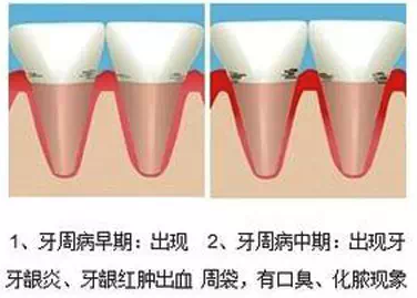 QQ截图20161011102353.png