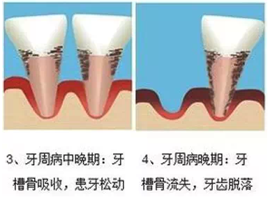 QQ截图20161011102411.png