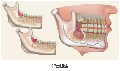 QQ截图20161103165251.png