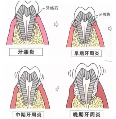 QQ截图20161108164158.png