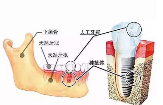 QQ截图20161109110604.png