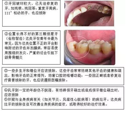 QQ截图20161206131627.png