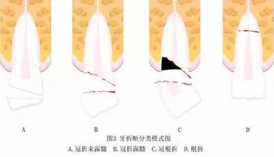 QQ截图20161206131921.png