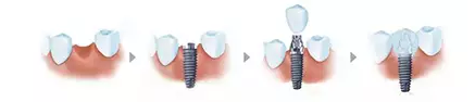 QQ截图20170307111557.png