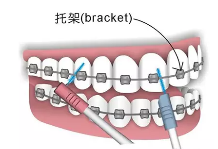QQ截图20170314162829.png