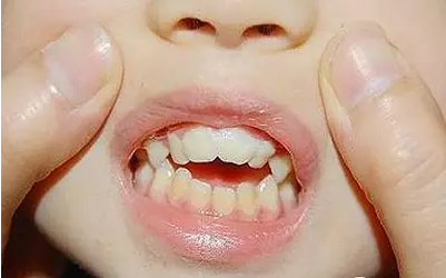 QQ截图20170314165007.png