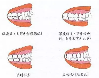 QQ截图20170314165024.png