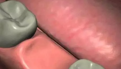 QQ截图20170315110150.png