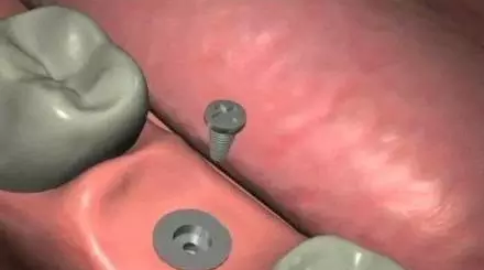 QQ截图20170315110236.png