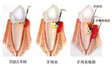 QQ截图20170316133401.png