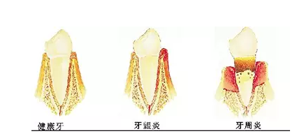 QQ截图20170316133420.png
