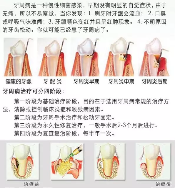 QQ截图20170317143541.png