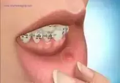 QQ截图20170323143505.png
