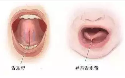 QQ截图20170324162346.png QQ截图20170324162346.png