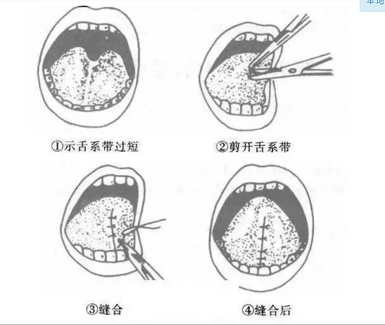 QQ截图20170324162451.png QQ截图20170324162451.png