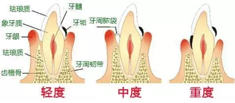 QQ截图20170408170255.png