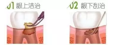 QQ截图20170408170324.png