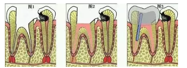 QQ截图20170419100611.png