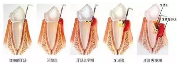 QQ截图20170419100656.png