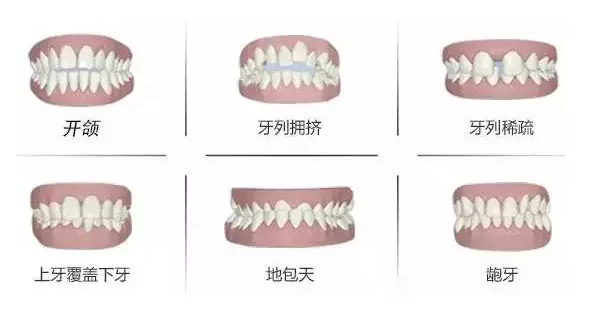 QQ截图20170421101159.png