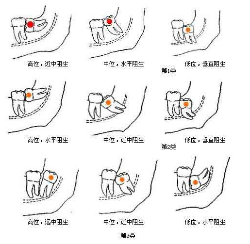 QQ截图20170727164210.png