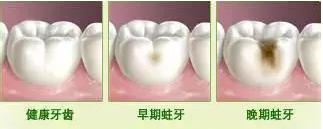 QQ截图20170830095740.png