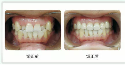 QQ截图20171016135642.png