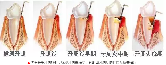 QQ截图20171030155004.png