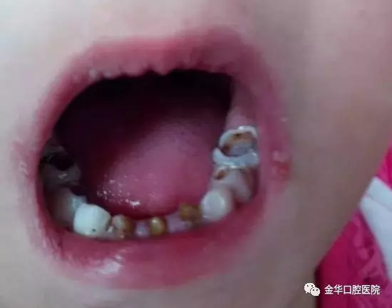 QQ截图20171110153358.png QQ截图20171110153358.png