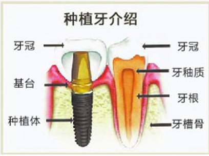 QQ截图20171117135615.png