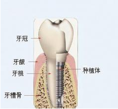 QQ截图20171117144322.png